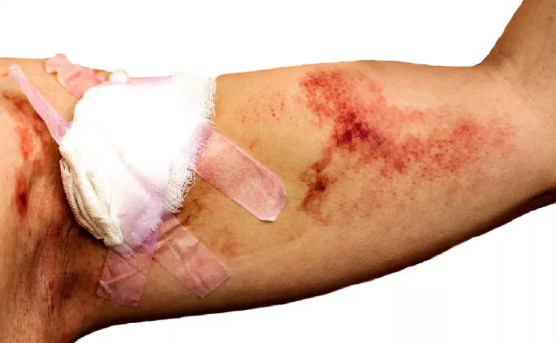 Bandage. Treatment of injury. Medical band aid. Cut with blood